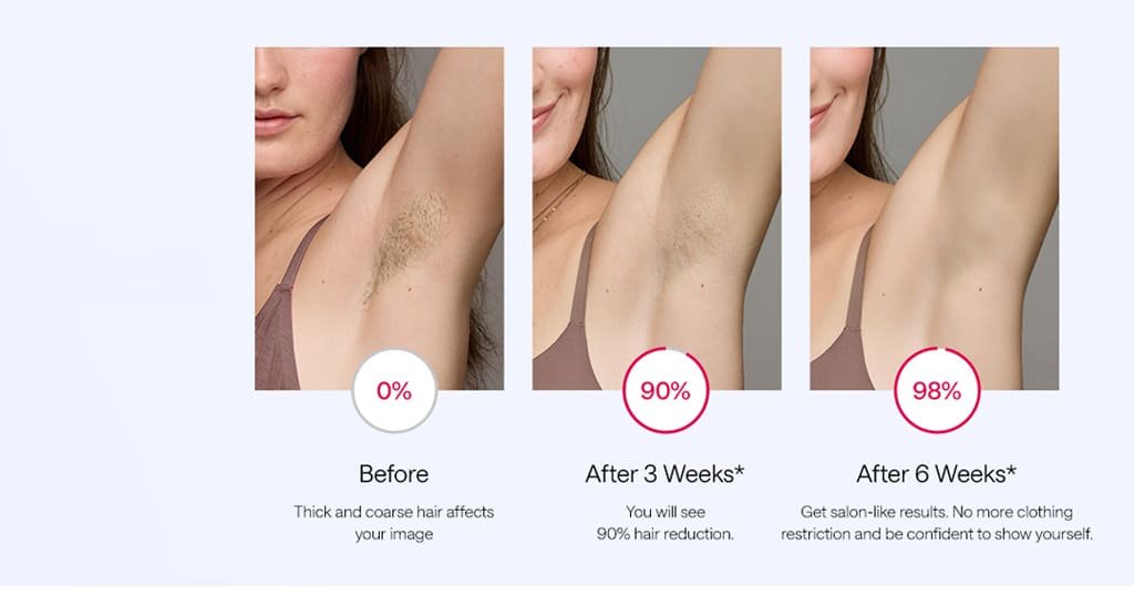 Ulike vs other brands